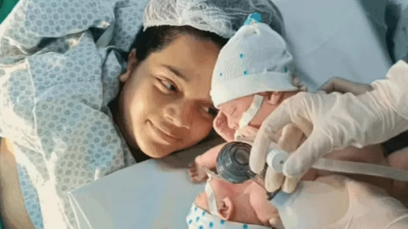 Morrem gêmeos siameses de casal mato-grossense; médicos tentaram cirurgia de separação de emergência