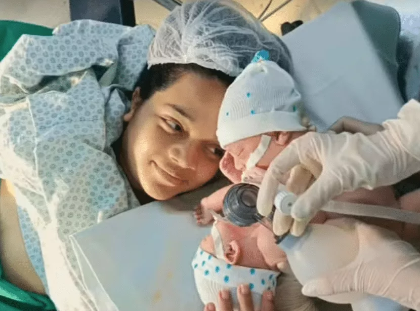 Morrem gêmeos siameses de casal mato-grossense; médicos tentaram cirurgia de separação de emergência