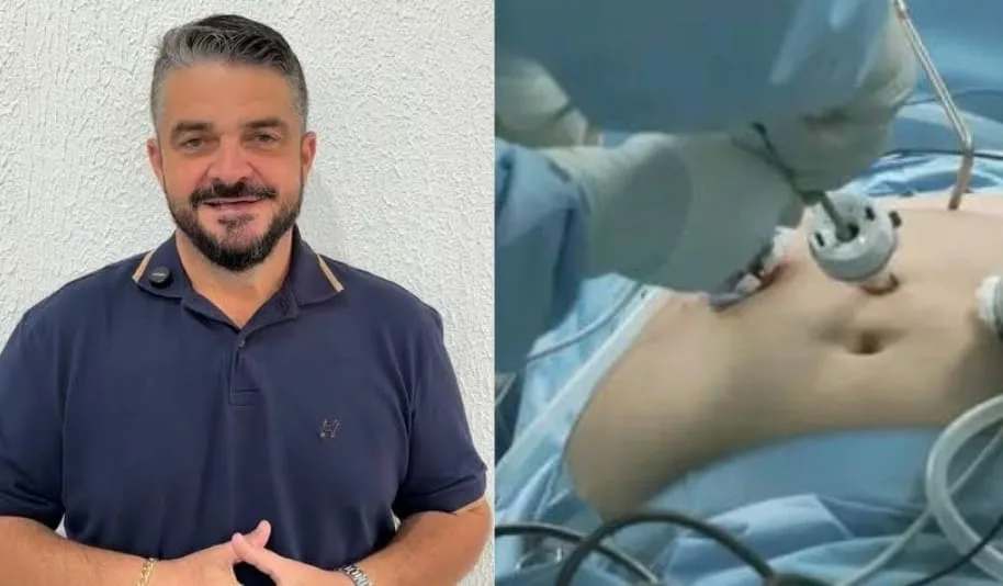 Cirurgia Bariátrica pelo SUS em Sinop: Um Guia Completo